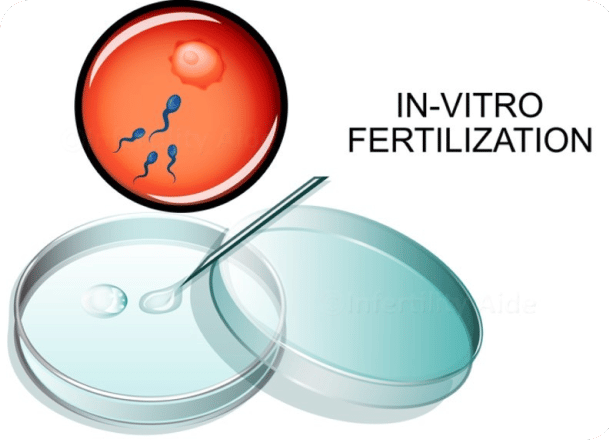 in-vitro fertilization equipments